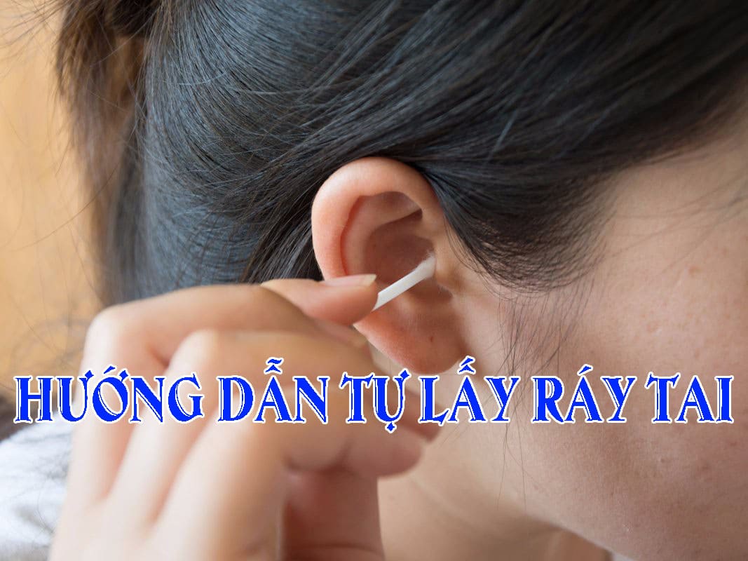 Ráy tai là gì? Ráy tai nhiều là bệnh gì