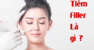 tiem filler la gi