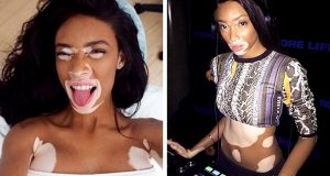 11 người mẫu nổi tiếng thế giới vì vẻ ngoài kì lạ chẳng giống ai - Ảnh 1.