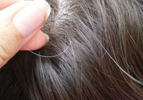 Hiện tượng tóc bạc sớm