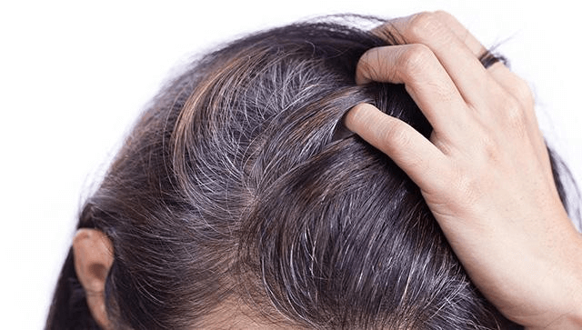 Tìm nguyên nhân tóc bạc sớm ở thanh niên 