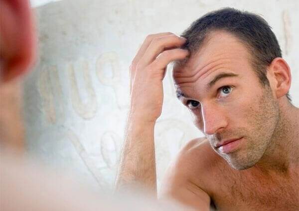 Những nguyên nhân chính gây ra hiện tượng hói đầu ở nam giới