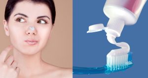 15 Cách trị mụn bọc an toàn và nhanh nhất! 6 tri mun bang kem danh rang